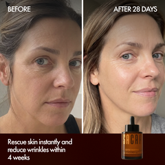 Before and after 28 days with Elixir Intense Serum