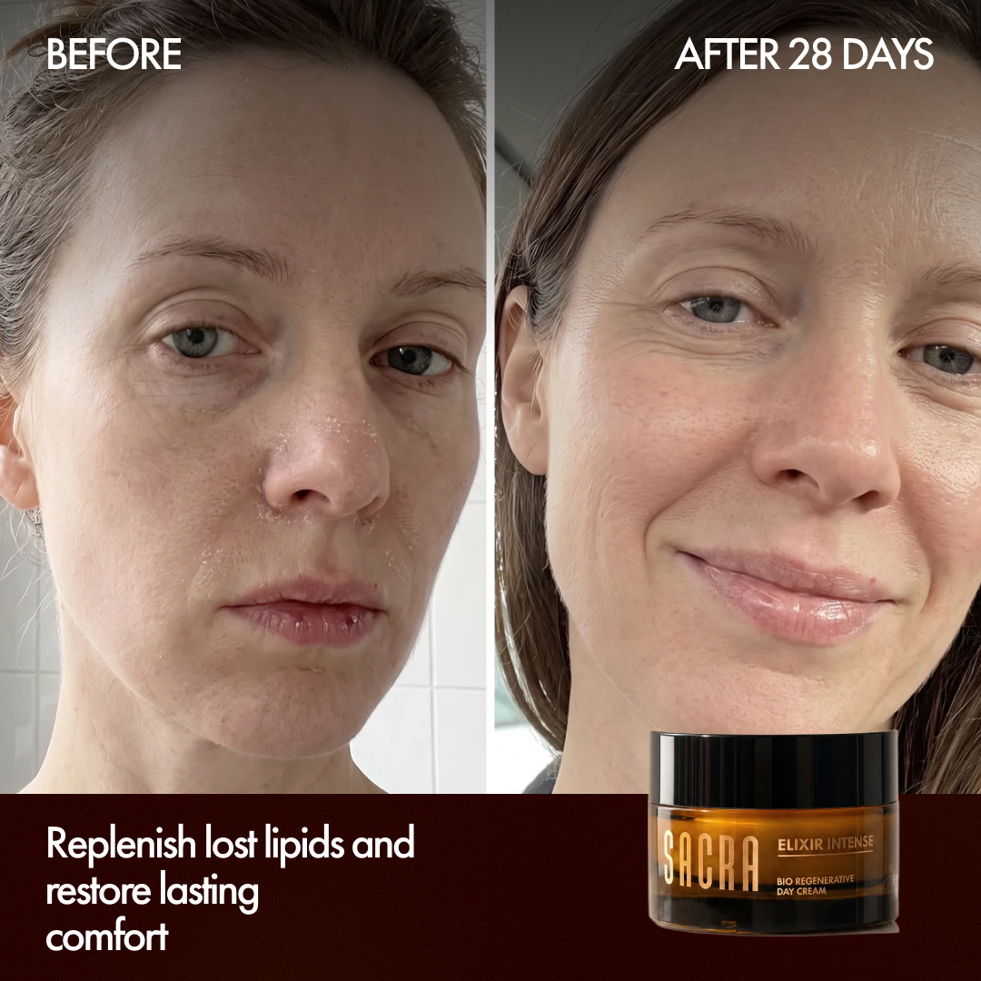 Before and after 28 days with Elixir Intense Day Cream