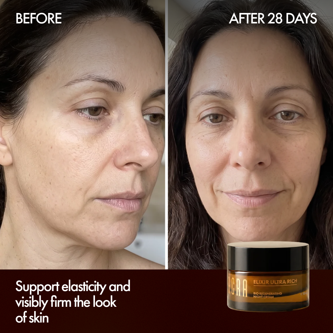 Before and after 28 days with Elixir Ultra Rich Night Cream
