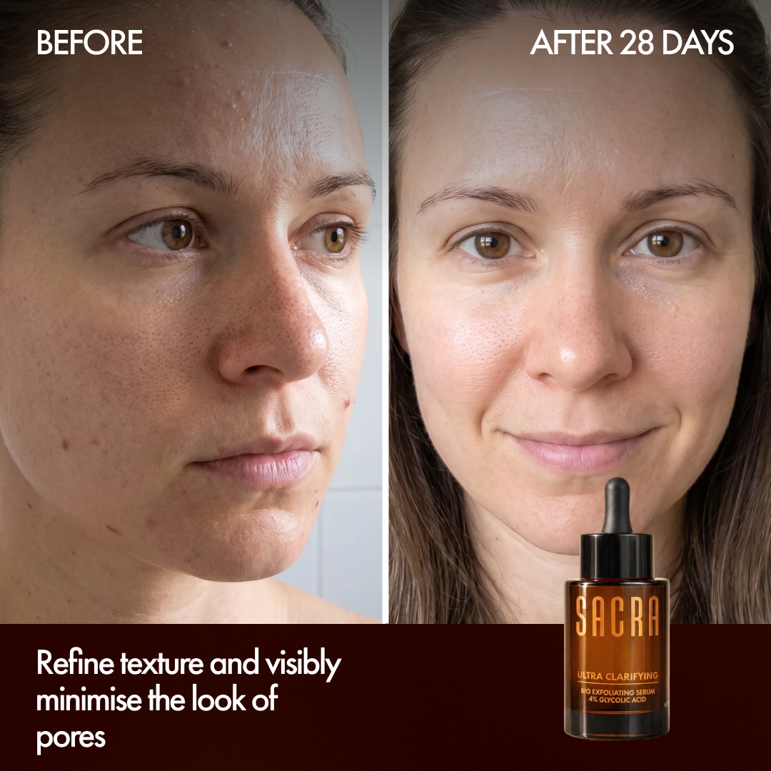 Before and after 28 days with Ultra Clarifying Serum