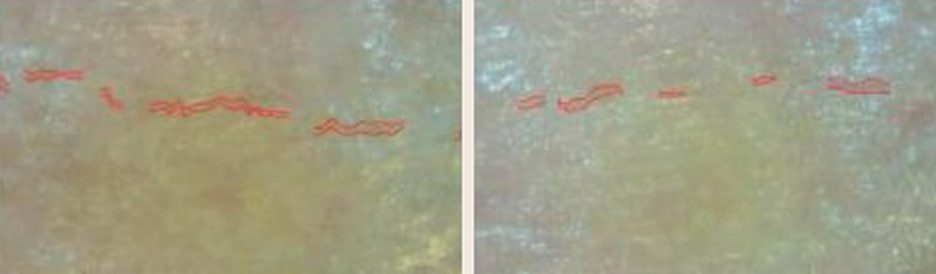 Wrinkle measurement, dermatological imaging. Left: before. Right: after 4 weeks.